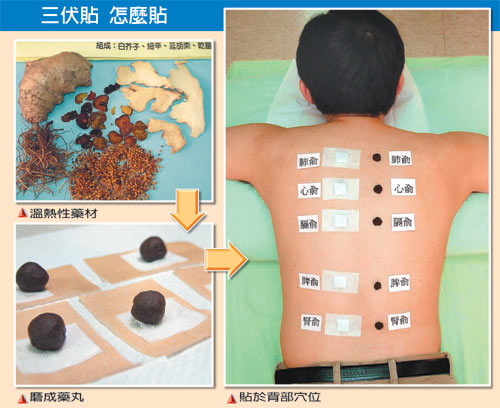 三伏天说“三伏贴”应注意什么